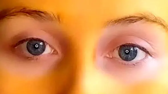 ماسک زردچوبه این زن را به دردسر انداخت !