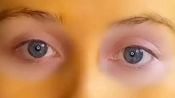 ماسک زردچوبه این زن را به دردسر انداخت !