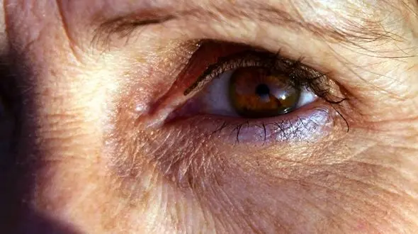 پیری زودرس با  آلودگی هوا