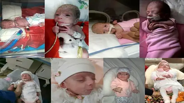 ماجرای تولد نوزاد نیم کیلویی در قم+ عکس عجیب
