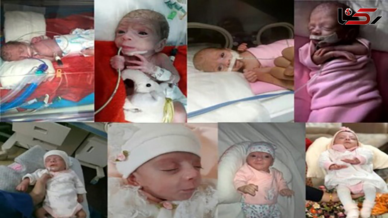 ماجرای تولد نوزاد نیم کیلویی در قم+ عکس عجیب
