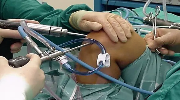 جراحی بی سر و صدای کاپیتان تیم ملی + عکس