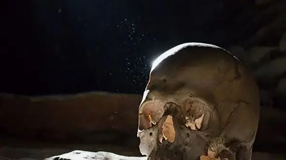 کشف جمجمه چینی جراحی شده در 2700 سال پیش