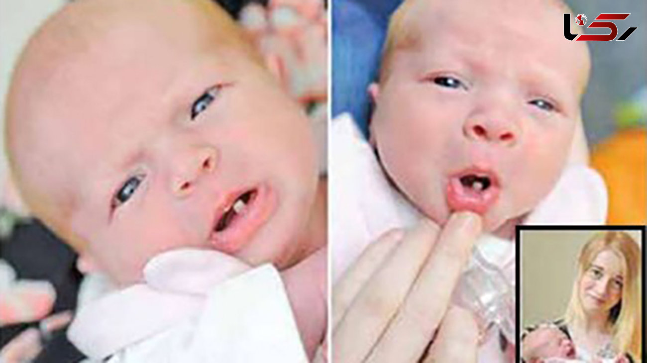 تولد این نوزاد عجیب باعث شگفتی همه شد+عکس
