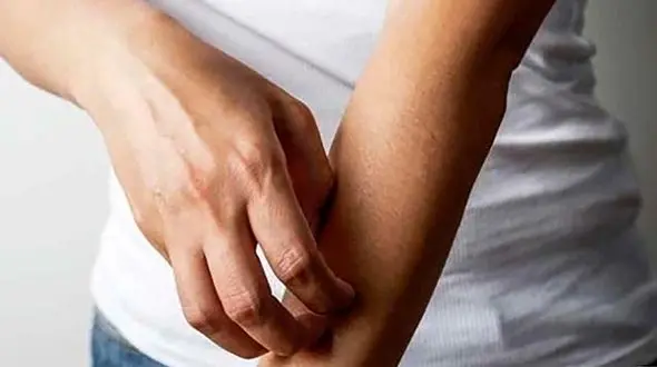 حس راه رفتن حشره روی پوست نشانه چه بیماری است؟