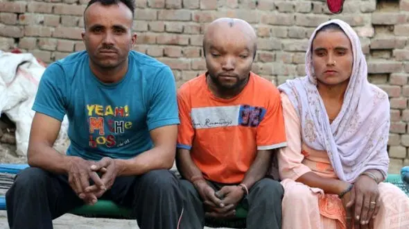 بیماری این جوان پزشکان را حیرت زده کرد + تصاویر 