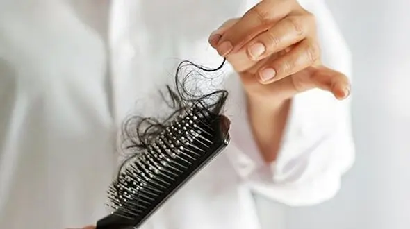نکات طلایی که باید درباره ریزش مو بدانید