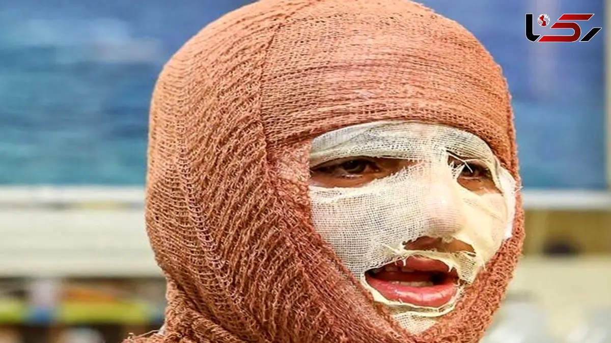 آیا سوختگی های عمیق قابل درمان هستند؟ راهکارهای نوین کدامند؟