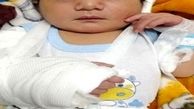 عکس نوزاد خرمشهری که با دست شکسته به دنیا آمد 
