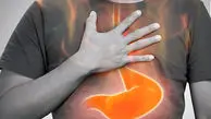 ریفلاکس فقط سوزش معده نیست؛ علائمی پنهان که بسیاری نادیده می‌گیرند