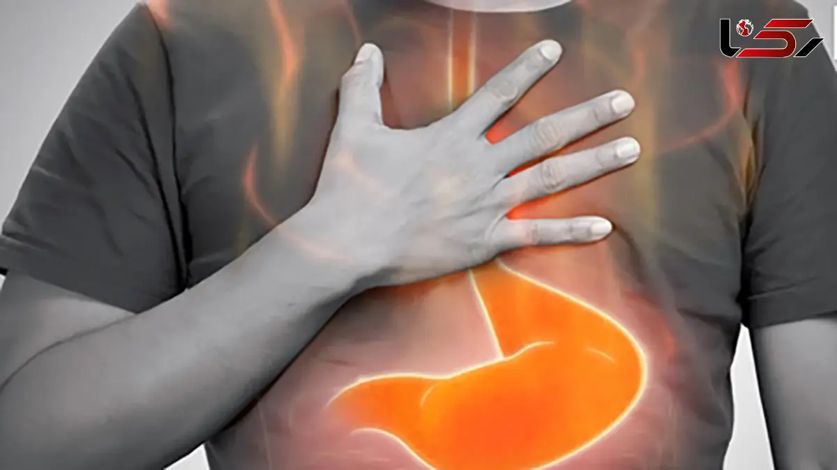 ریفلاکس فقط سوزش معده نیست؛ علائمی پنهان که بسیاری نادیده می‌گیرند