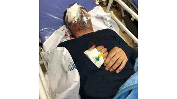 حادثه وحشتناک برای تکنسین هواپیما در اهواز  / چشم او تخلیه شد + عکس