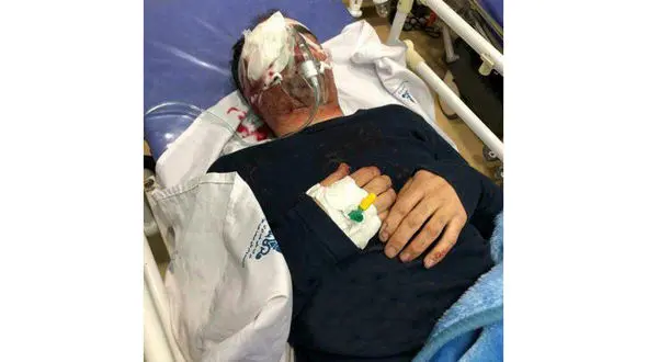 حادثه وحشتناک برای تکنسین هواپیما در اهواز  / چشم او تخلیه شد + عکس