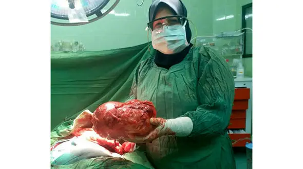 غده سه کیلویی از بدن بیمار جهرمی خارج شد