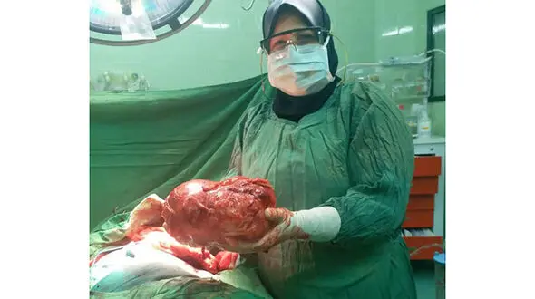 غده سه کیلویی از بدن بیمار جهرمی خارج شد