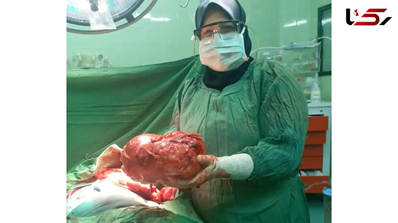 غده سه کیلویی از بدن بیمار جهرمی خارج شد