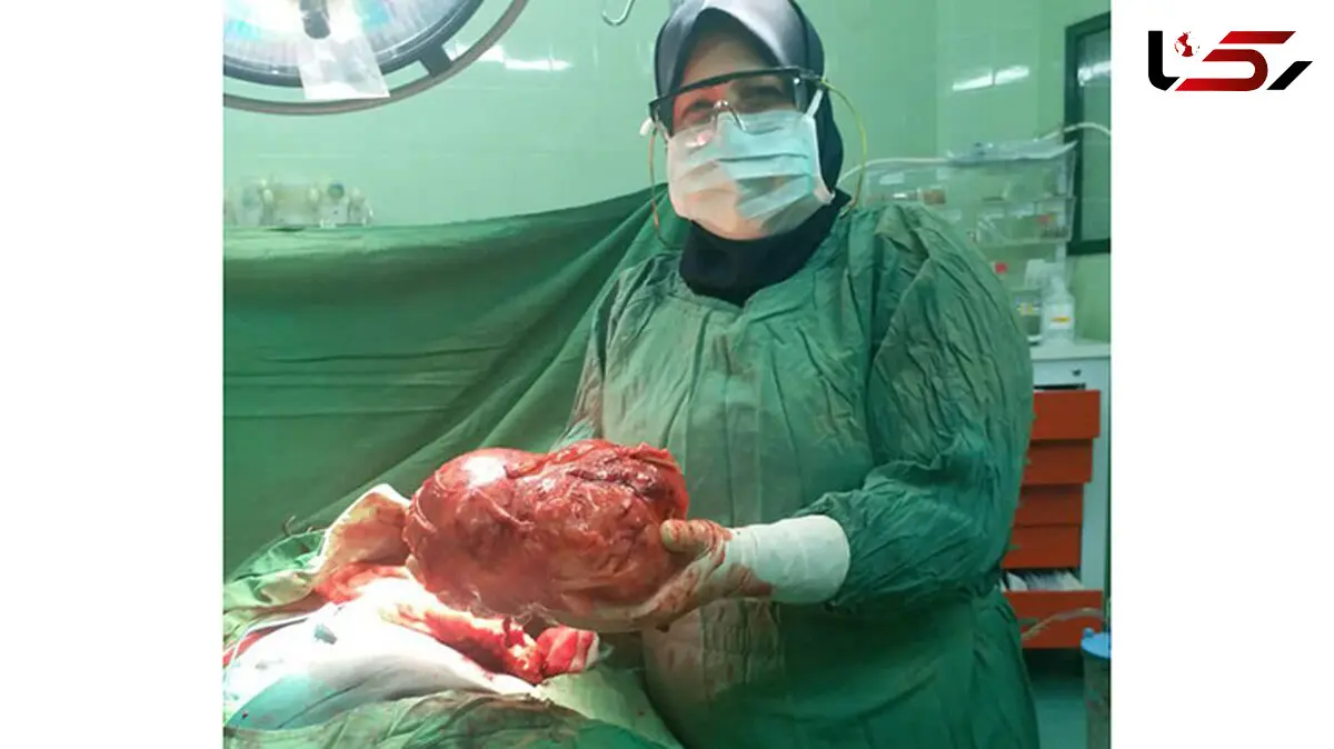 غده سه کیلویی از بدن بیمار جهرمی خارج شد