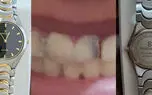 ساعتی که برای درمان دندان یک دانش‌آموز به مزایده گذاشته شد، حالا مدرسه می‌سازد