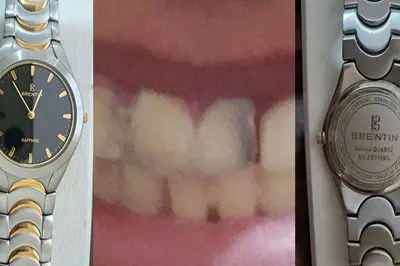 ساعتی که برای درمان دندان یک دانش‌آموز به مزایده گذاشته شد، حالا مدرسه می‌سازد