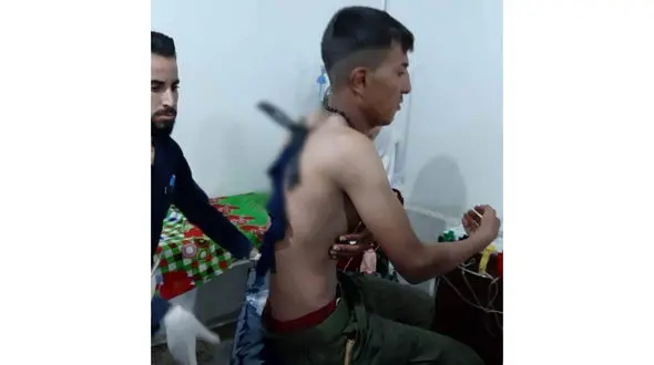 عکس وحشتناک از فرو رفتن چاقو در بدن یک مرد / زن چاقوکش کیست؟ + جزییات