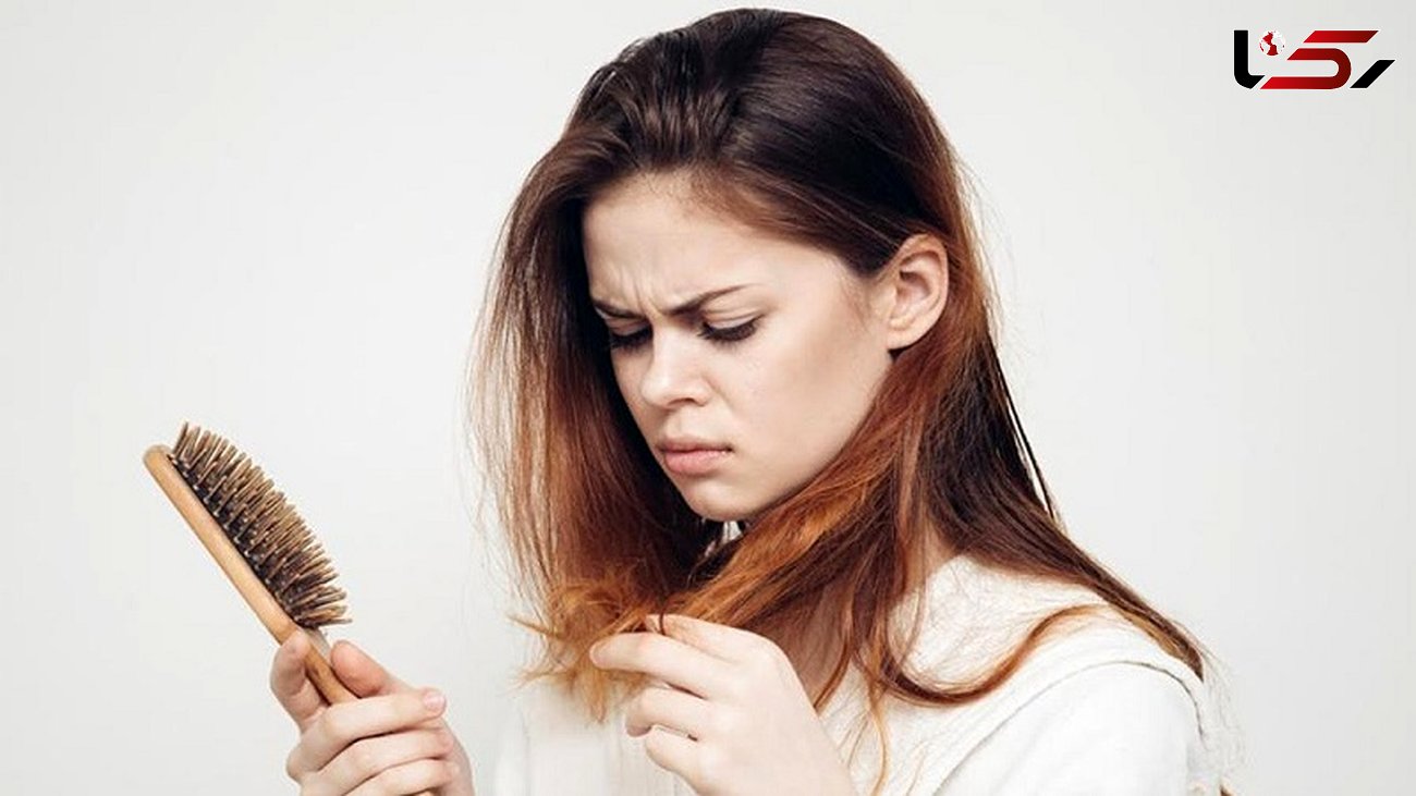  متخصصان برای درمان ریزش مو راهکارهای جدید ارائه دادند