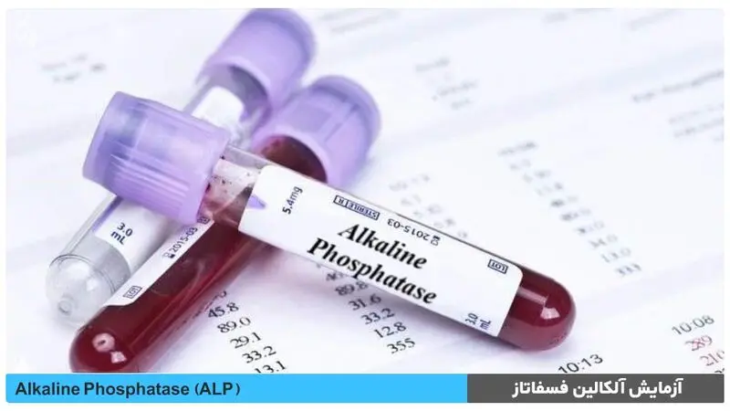 alk.phos در آزمایش خون چیست