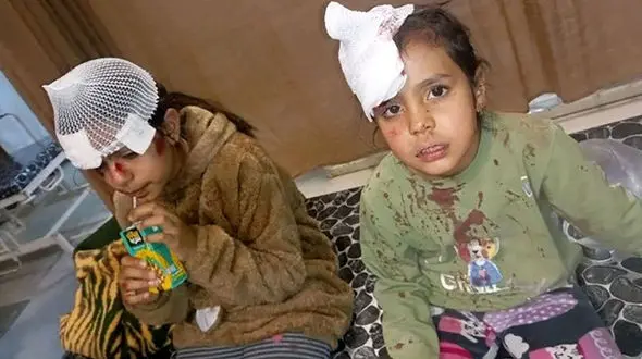 حمله سگ‌های ولگرد به 2 دختر کرمانی / تولید مثل خطرناک سگ های ولگرد در اکثر شهرهای کشور