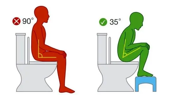 کدام توالت برای سلامتی ما بهتر است؛ فرنگی یا سنتی؟