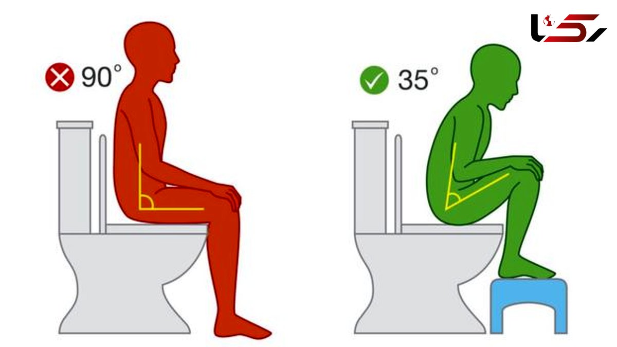 کدام توالت برای سلامتی ما بهتر است؛ فرنگی یا سنتی؟
