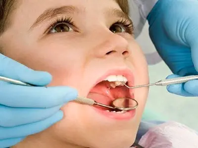 بحران خاموش در دهان کودکان؛ پوسیدگی از مدرسه شروع می‌ شود