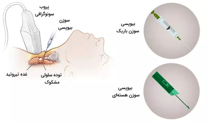 پاتولوژی چیست