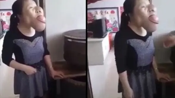 تغییر چهره وحشتناک زن چینی بر اثر سرطان + فیلم