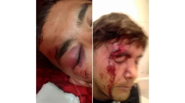 عکس تکاندهنده از جر خوردن صورت پسری با چاقوی دزدان !