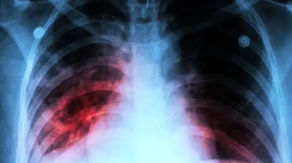 آمار وحشتناک دو بیماری هولناک در ایران