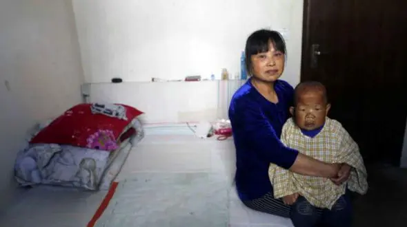 عجیب اما واقعی/ مرد 30 ساله ای که بچه است!+ عکس های عجیب