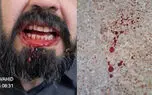 حمله خانواده یک دانش آموز به معلمی در شهرستان مهران / آموزش و پرورش پیگیری قضایی را آغاز کرد
