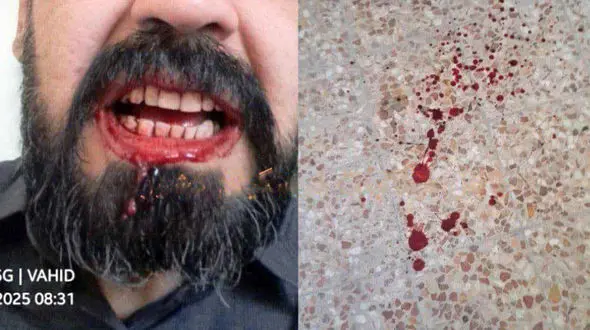 حمله خانواده یک دانش آموز به معلمی در شهرستان مهران / آموزش و پرورش پیگیری قضایی را آغاز کرد