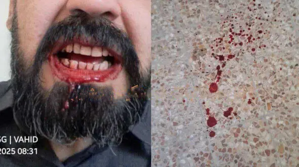 حمله خانواده یک دانش آموز به معلمی در شهرستان مهران / آموزش و پرورش پیگیری قضایی را آغاز کرد