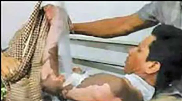 زن عصبانی شوهرش را به خاطر رمز تلفن همراهش به آتش کشید+ عکس