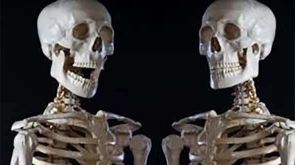 رونق تجارت اعضای بدن آدم های مشهور در حراجی های بزرگ! + تصاویر