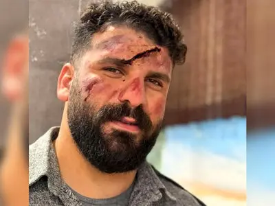 عکس میلاد کرمی بلاگر معروف به وضعتان چونه بعد از سقوط از کوه ../ اینبار وضعتان خرابه ... + فیلم