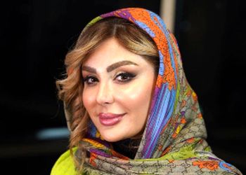 آرایش شیک و ساده نیوشا ضیغمی در مهمانی خصوصی! / ساده ترین عکس خانم بازیگر بعد از عمل مجدد بینی!