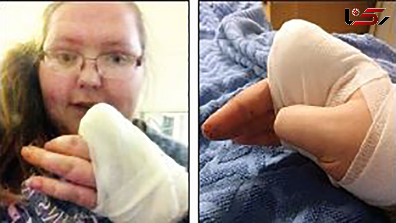 زن جوان وقتی نتوانست درد انگشتانش را تحمل کند آنها را قطع کرد+ عکس