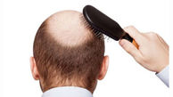 میزان ریزش طبیعی موی سر چقدر باید باشد؟