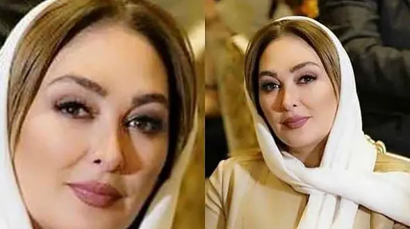 عکس قبل و بعد لاغری  الهام حمیدی  