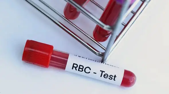 RBC چیست؟ + جدول بیماری هایی که نیاز به آزمایش RBC دارد