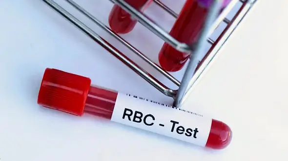 RBC چیست؟ + جدول بیماری هایی که نیاز به آزمایش RBC دارد