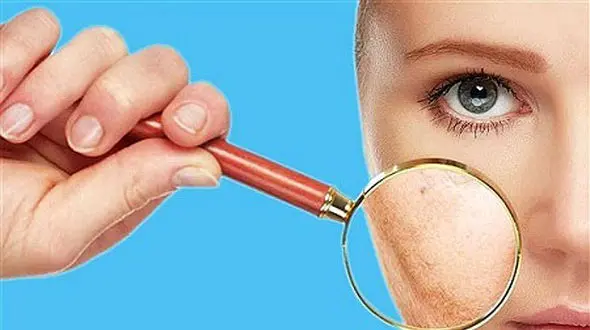 این هشدارهای پوستی نشانه اشتباهات تغذیه ای است