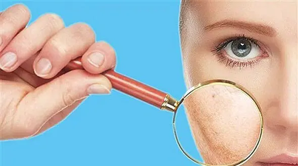 این هشدارهای پوستی نشانه اشتباهات تغذیه ای است