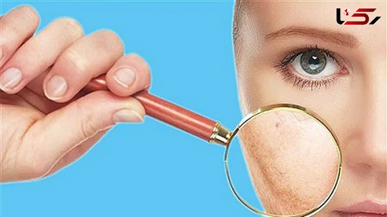 این هشدارهای پوستی نشانه اشتباهات تغذیه ای است